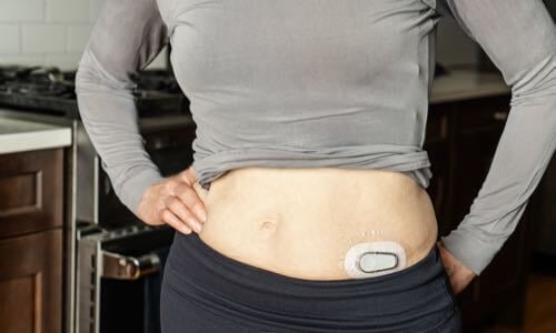 Close-up of woman standing in the kitchen with her shirt lifted showing her abdomen with CGM