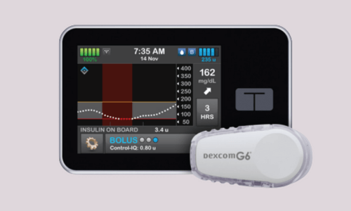 Tandem Diabetes Care app paired with a Dexcom G6 CGM sensor