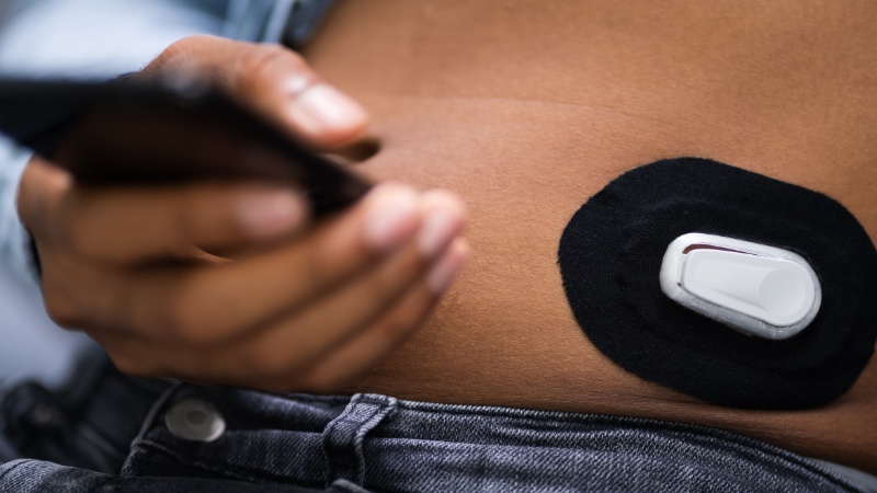 Diverse person wearing a CGM on their stomach while holding a smartphone monitor
