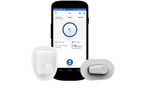 Omnipod DASH® personal diabetes manager (PDM), tubeless pod & Dexcom G6 sensor